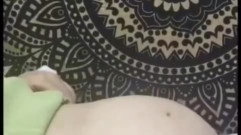 CURADA DE UN TUMOR CANCEROSO CON DIOXIDO DE CLORO, DMSO , ZEOLITA Y TREMENTINA