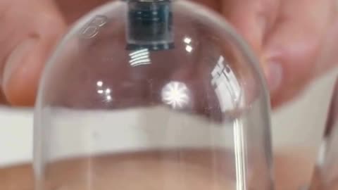 Effective Cupping Physiotherapy Treatment in Madurai for Pain Relief & Recovery
