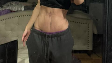 An amazing weight loss