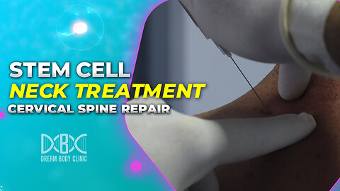 Stem Cell Neck Treatment - Cervical Spine Repair