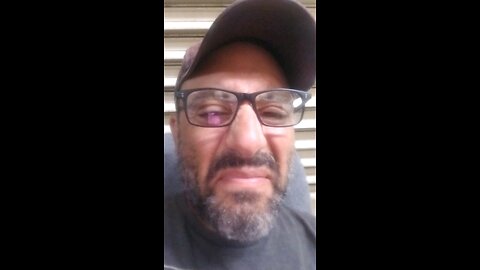 Shitty fingers on shitty people....