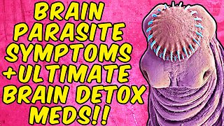 Brain Parasite Symptoms + The Ultimate Brain Parasite Detox Meds!