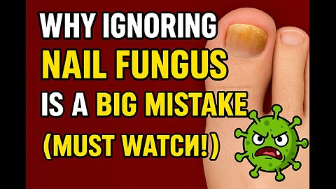 Why Ignoring Nail Fungus Can Wreck Your Health (Must Watch!)