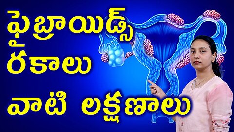 ఫైబ్రాయిడ్స్ రకాలు వాటి లక్షణాలు Signs Types of Uterine Fibroids Removal Homeopathy Treatment Cure