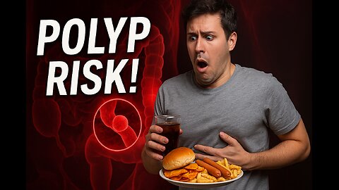 Ultra-Processed Foods Linked to Higher Risk of Colon Polyps