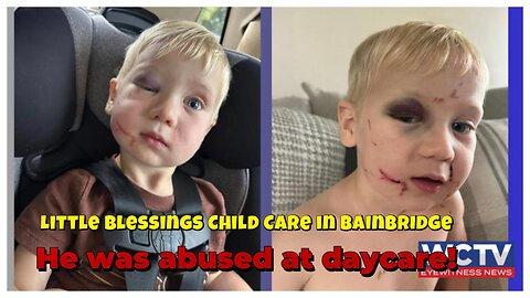 Undetected Footprints of this little boy getting punched and abused by a daycare worker!