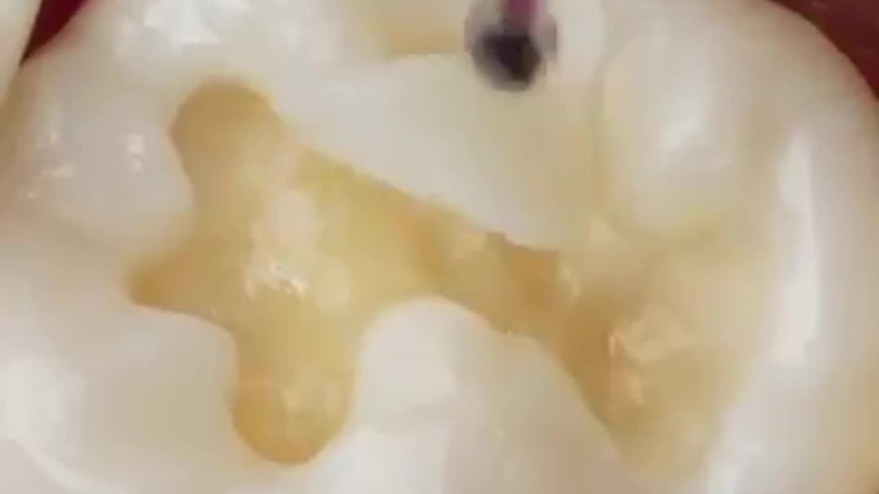 So this is how they do it 🦷
