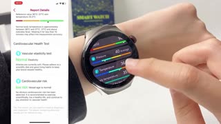 New Men Women Physical Examination ECG BP Blood Lipids Uric Acid Bluetooth Call Smart watch