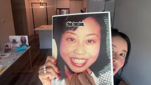 E Smile vs V Smile: The Right Way to Smile for a Youthful, Lifted Face