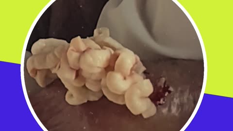 Pimple removal satisfying video (ASMR) #7 #shorts