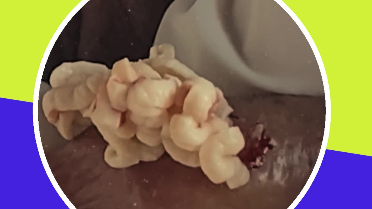 Pimple removal satisfying video (ASMR) #7 #shorts