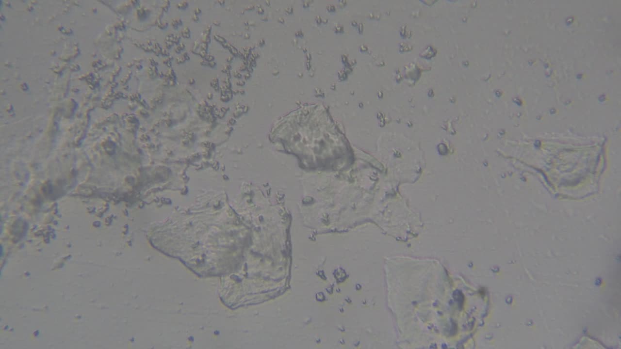Ear Swab Cytology