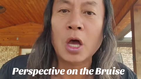 Gene Ho-Perspective on the Bruise on Pres. Trump's hand