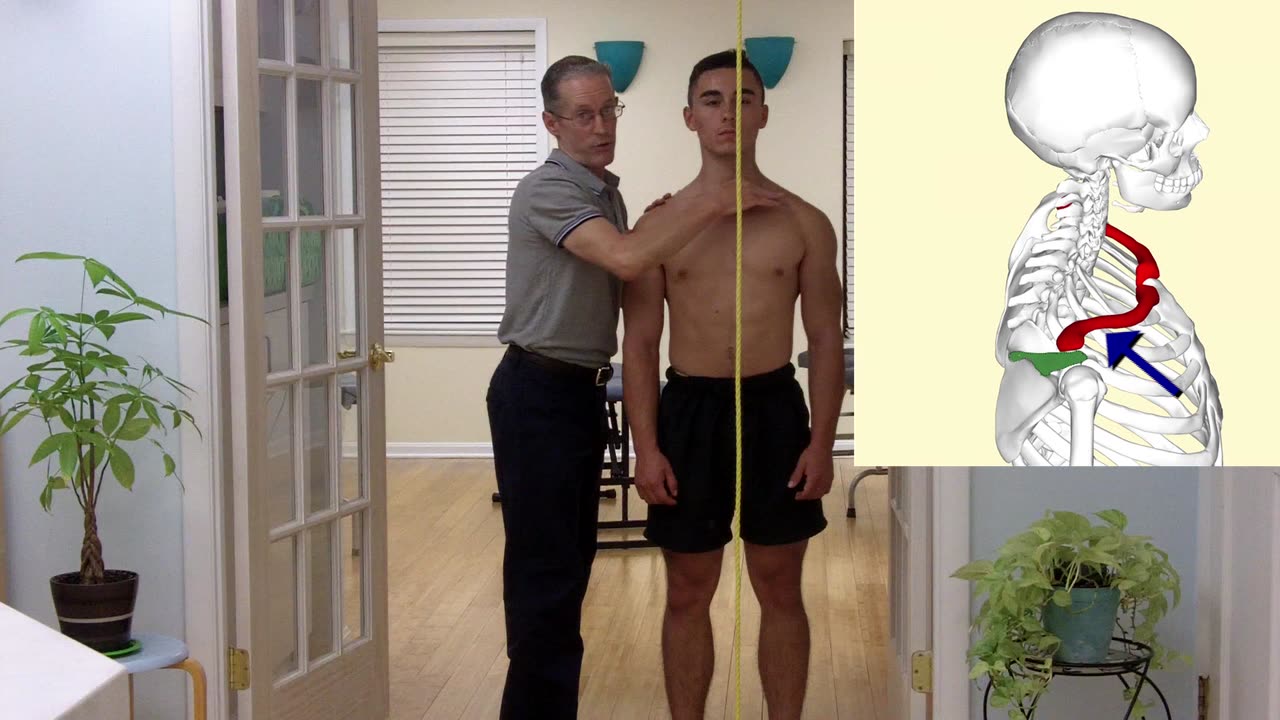 How to Evaluate Your Posture as Viewed From the Side