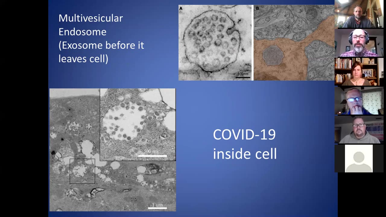 Sars-cov2 and HIV were both just images of Exosomes
