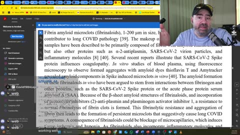SARS-CoV-2 spike protein amyloid fibrils impair fibrin formation and fibrinolysis (Review) Part 3