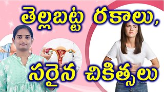 తెల్లబట్ట రకాలు సరైన చికిత్సలు Types Of Leucorrhea Best Homeopathy Treatment Guide Medicine Cure