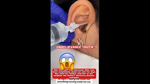 A little girl from Cleveland went to the for ear pain…What the doctor found shocked everyone😱