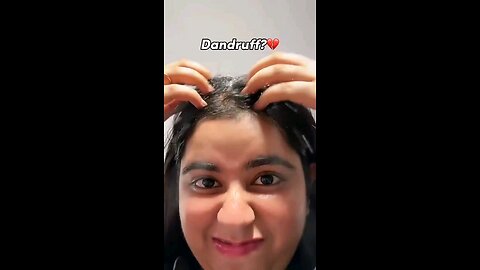 dandruff