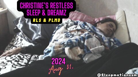Restless Sleep At Camp ⏰Aug 31, 2024 😴 RLS & PLMD