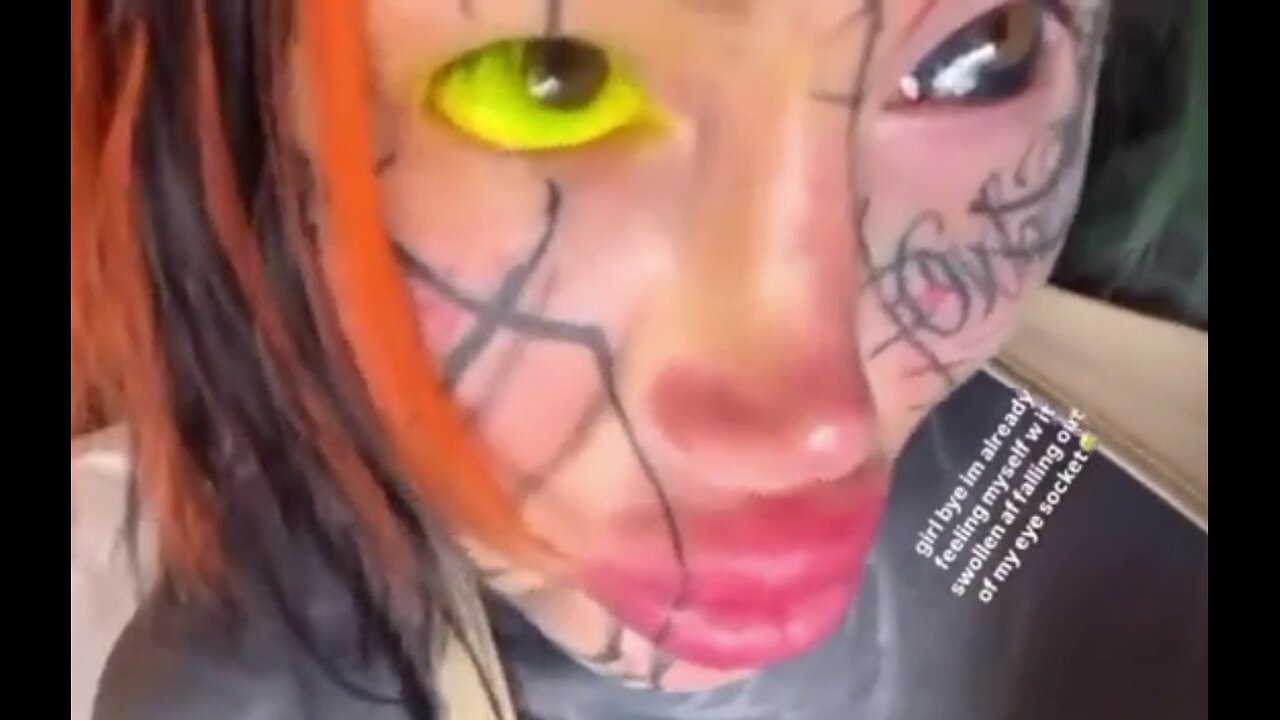 Blind because of an EyeBall Tattoo