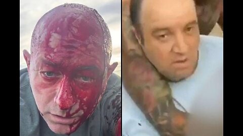 THE BONDI BEACH TERROR ATTACK BECAME ISRAEL'S ₪ MOST EMBARRASSING FALSE FLAG FLOP YET❗