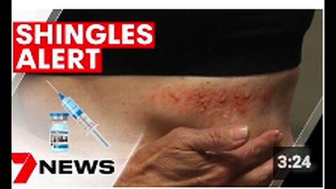 "Diagnosis: Shingles"