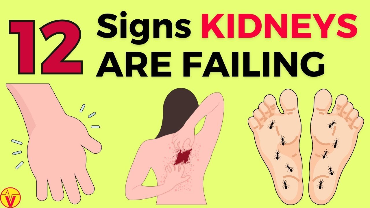 Could These 12 Bizarre Symptoms Mean Your Kidneys Need Help Now? VJ34