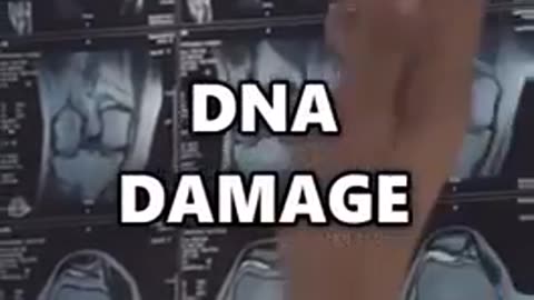 cell tumors
