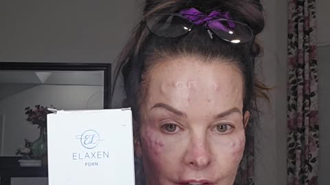 Neck treatment with our old school product, Elaxen PDRN.