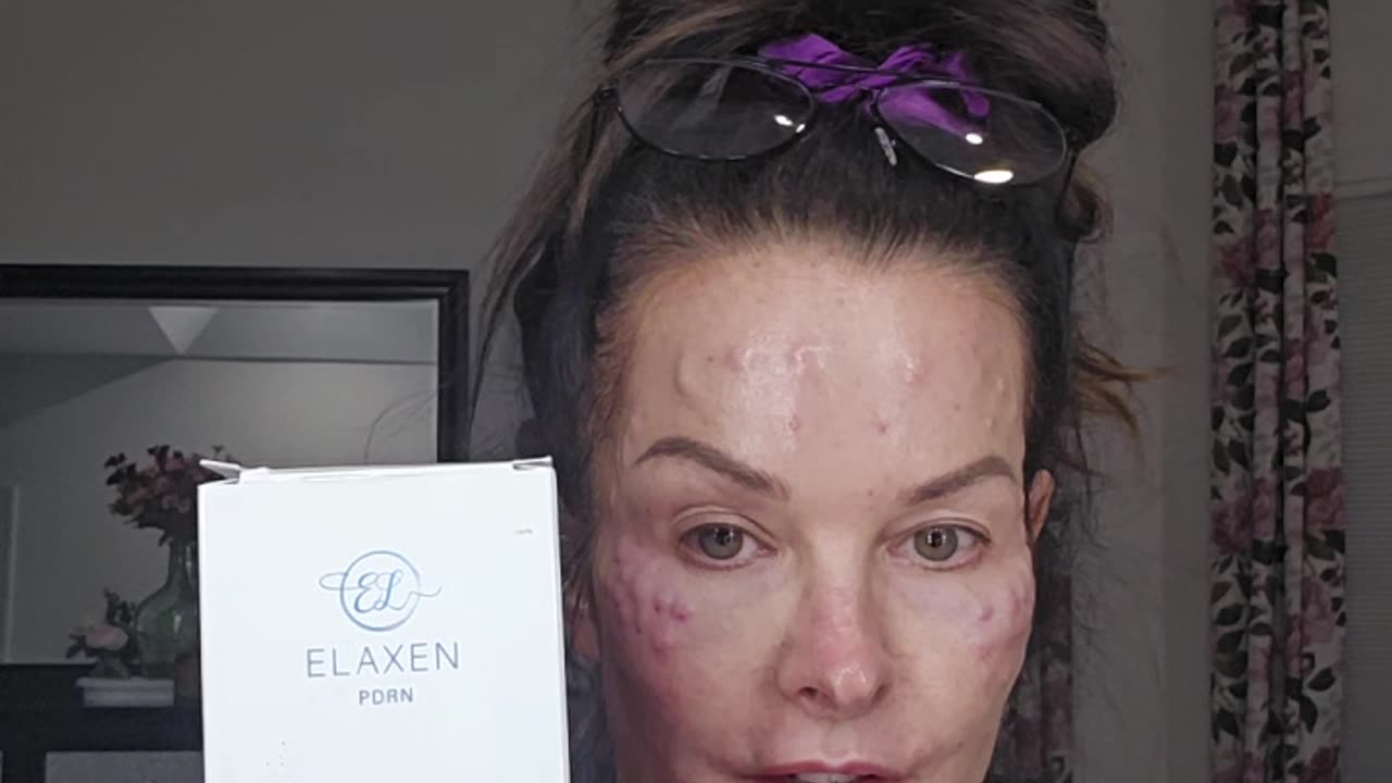 Neck treatment with our old school product, Elaxen PDRN.