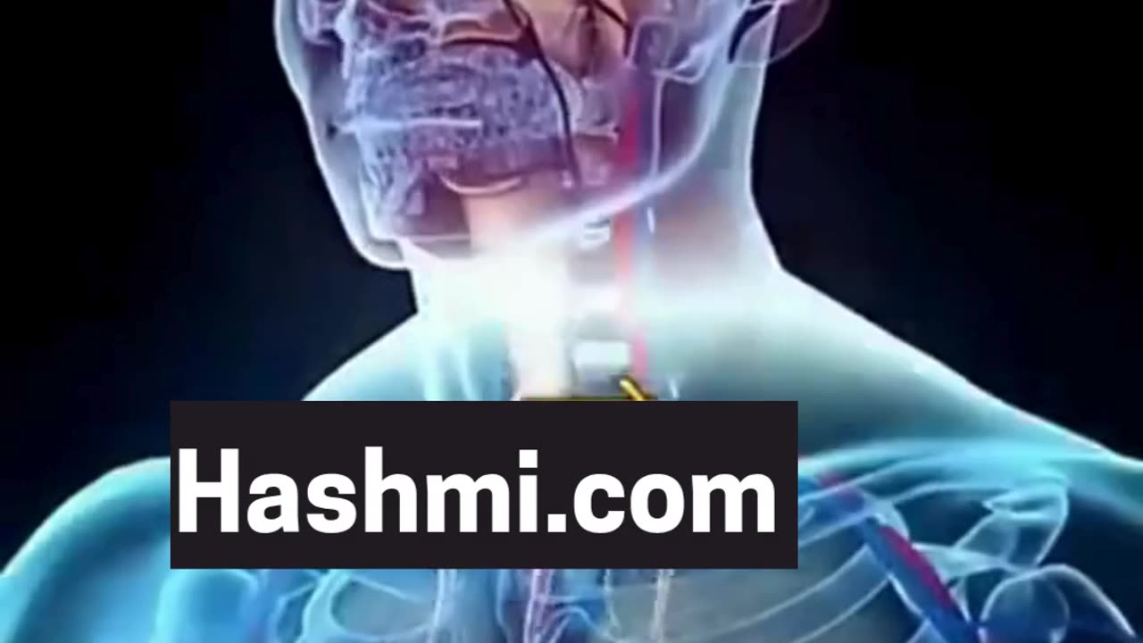 बॉडी बनाने का ये रामबाण उपाय भूल से भी ट्राई मत करना।••Follow me 👉#viral #like #follow #trending