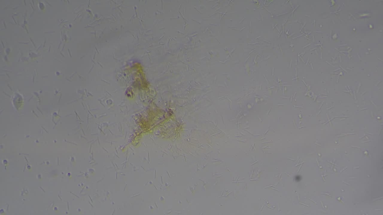 Rod Bacteria