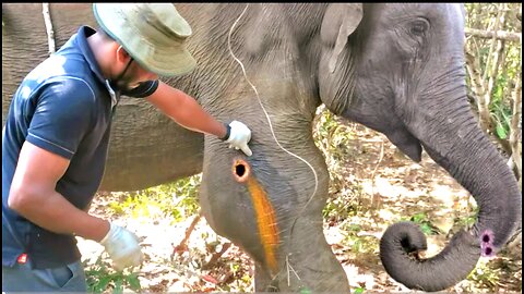 Treatment for gunshot wound to the leg despite the risk 😮😮
