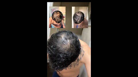 #drforhairupdate #haircare #hairgrowth #kbeauty #koreanhaircare
