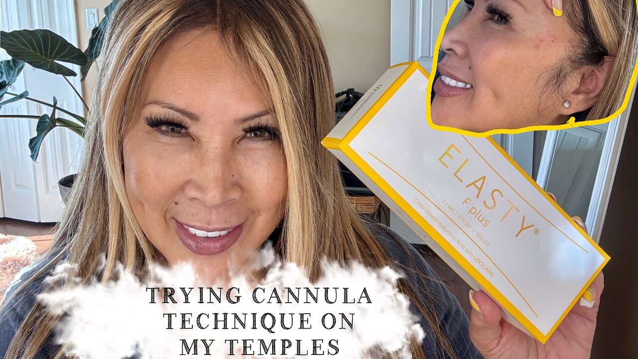 TRYING CANNULA TECHNIQUE ON MY SUNKEN TEMPLES | ELASTY F PLUS