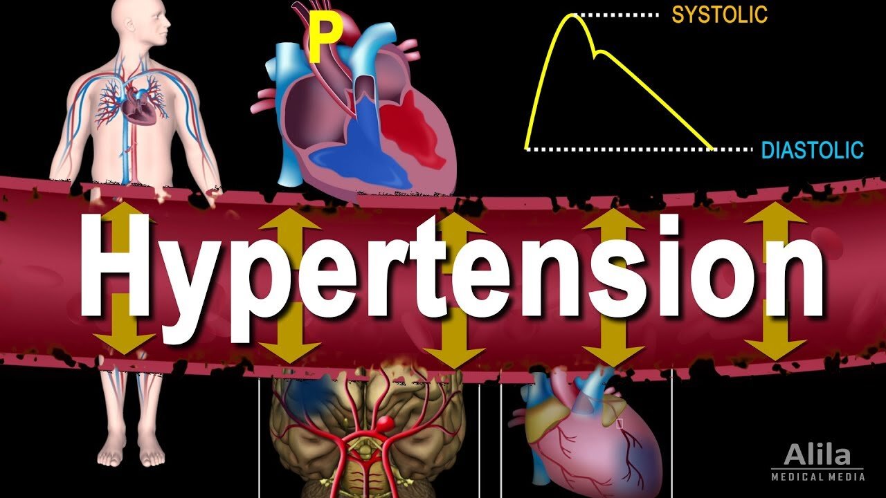 High Blood Pressure Or Hypertension