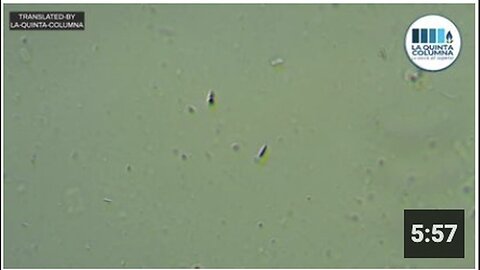 "Study of Polygonal Structures Through Optical Microscopy"