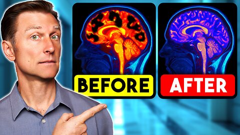 What Happens to Your Brain If You Ate NO Sugar for 21 Days?