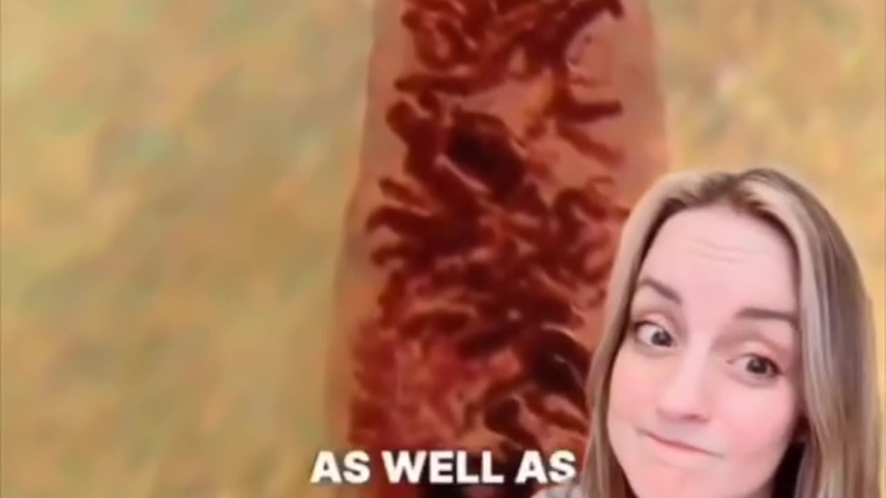 The WORST parasite you could ever contract THE FLUKE!