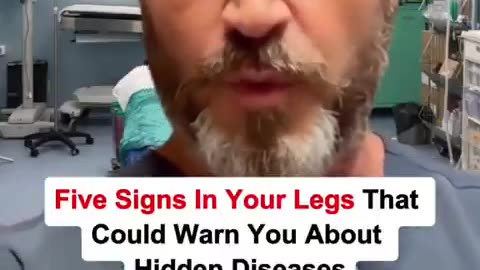 Five Signs In Your Legs That Could Warn You About Hidden Diseases