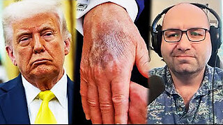 Trump has 4 months to live???