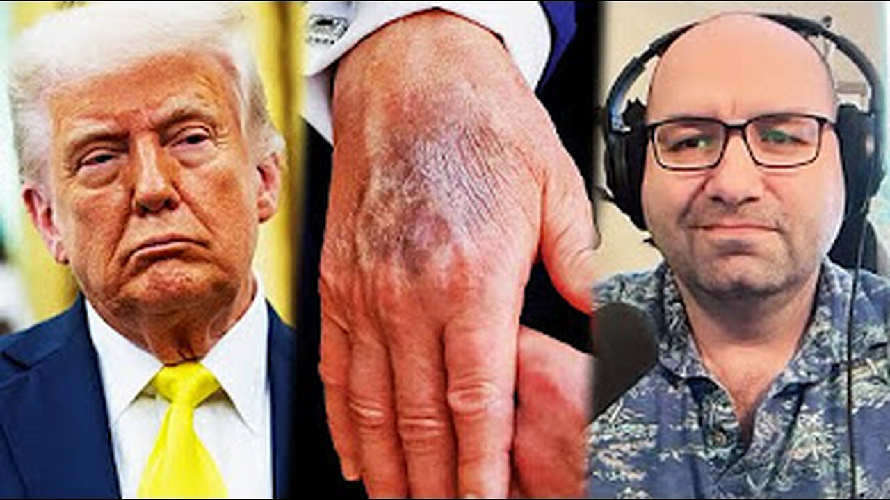 Trump has 4 months to live???