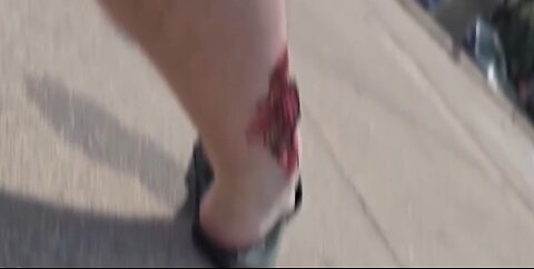 IP2 Stories - Nick White Breaks His Ankle! Script?