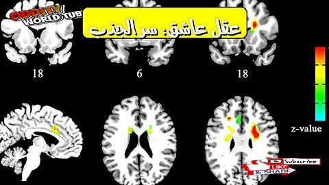 Brain in Love: The Neuroscience of Attraction #BrainScience #LoveFacts #Neurochemistry
