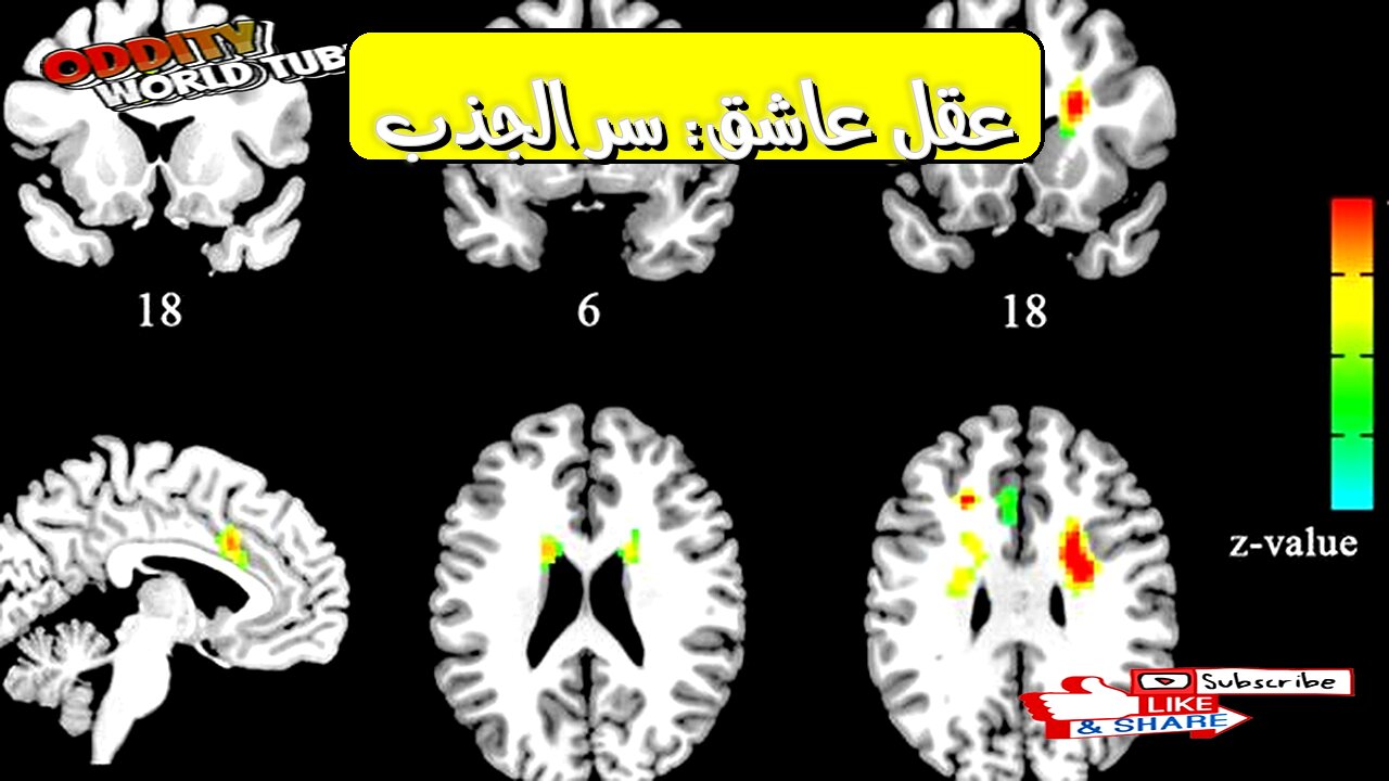 Brain in Love: The Neuroscience of Attraction #BrainScience #LoveFacts #Neurochemistry