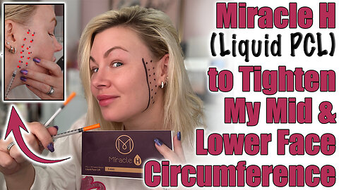 Miracle H (Liquid PCL) Tighten My Mid & Lower Face Circumference, AceCosm.com | Code Jessica10 Saves