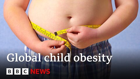 More children are obese than underweight, says Unicef | BBC News
