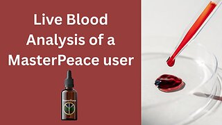 Live Blood Analysis of a MasterPeace user
