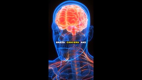 Cell Phones Have Been Around Long Enough, Studies Show It Causes Cancer & Other Diseases! Michael G